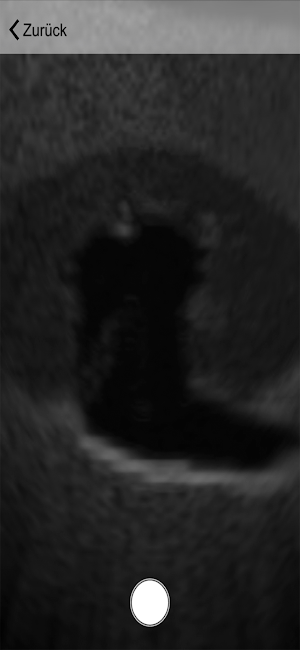 Ultraschall Screenshot 2