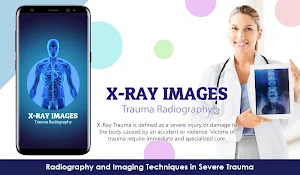 X-Ray Trauma Radiography Screenshot 0