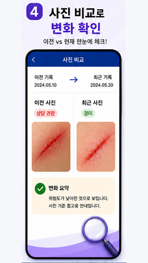 상처살핌 - 상처 관리 도우미 Screenshot 3
