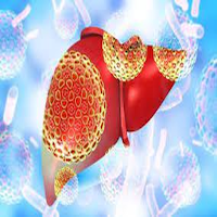 Expert system: HEPATITIS