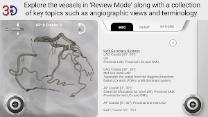 AngioAID 3D Screenshot 3