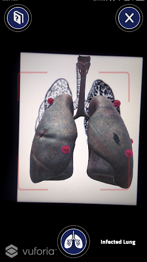 Healthy Lungs AR Screenshot 2