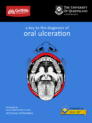 Diagnosis of Oral Ulceration Screenshot 0