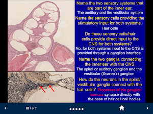 Neuroanatomy - SecondLook Screenshot 2