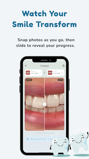 TrayKeeper: Aligner Tracker Screenshot 3