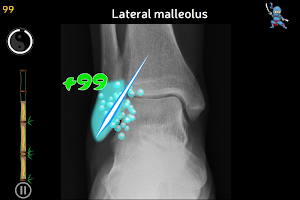 Anatomy Ninja Lower Limb Screenshot 3
