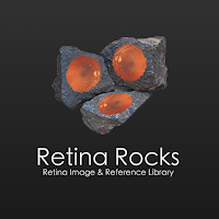 Retina Rocks