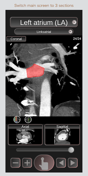 CT Passport Heart / sectional anatomy / MRI Screenshot 2