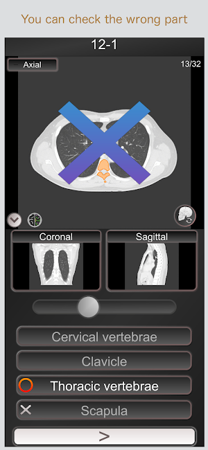 CT PassQuiz Chest / sectional anatomy / MRI Screenshot 1