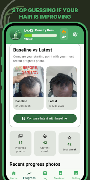 Follicle - Hair Growth Tracker Screenshot 0