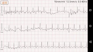 Heart Pal Screenshot 1