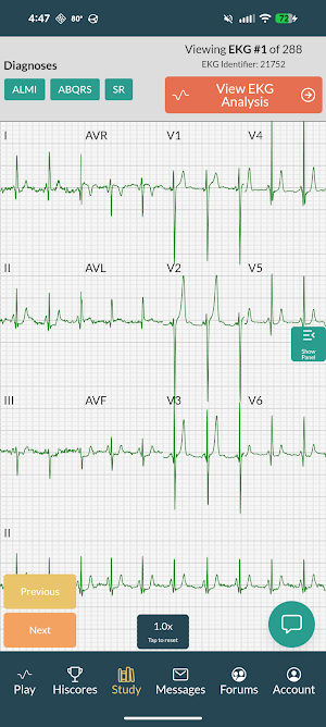 EKG Battle - Study & Compete Screenshot 0