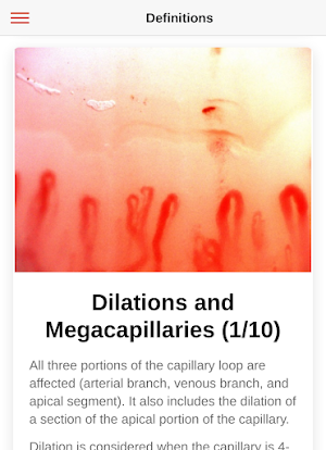 Capillaroscopy.app Screenshot 0