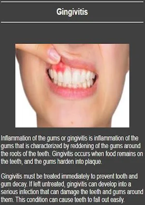 All dental diseases Screenshot 2