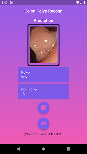 Colon Polyp Recogn Screenshot 2
