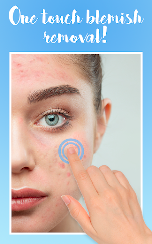 Blemishes Removal: beauty face camera Screenshot 1
