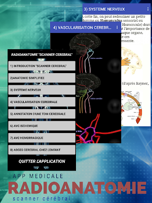 radio-anatomie"scanner cérébral" Screenshot 0
