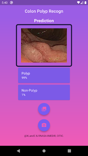 Colon Polyp Recogn Screenshot 1