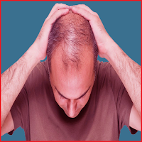 علاج تساقط الشعر