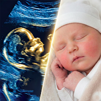 Ultrasound to Photo: BabyGuess