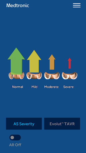 AS TAVR Education Screenshot 1