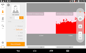 Skinview Screenshot 3