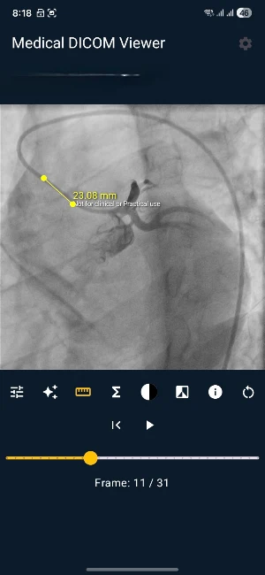 MDV - Medical Dicom Viewer Screenshot 1