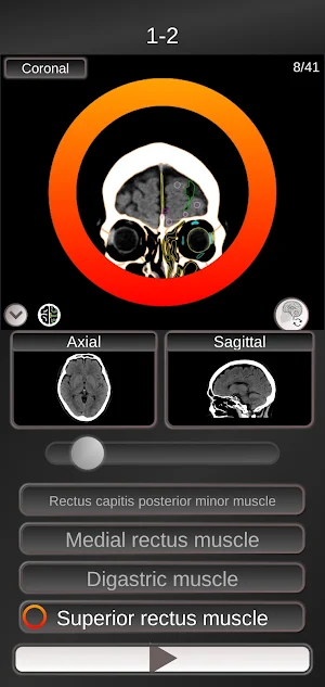 CT PassQuiz Head/Brain / sectional anatomy / MRI Screenshot 0