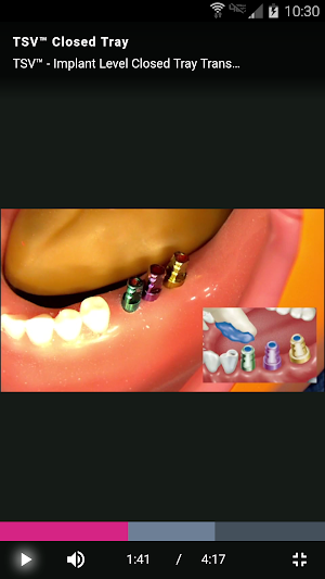 Zimmer Biomet Dental Education Screenshot 3
