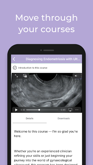 AIMEE: My Ultrasound Mentor Screenshot 2
