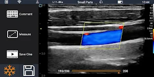 Youkey SonoiQ - Wireless Pocket Ultrasound System Screenshot 1
