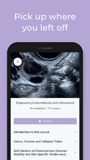 AIMEE: My Ultrasound Mentor Screenshot 1