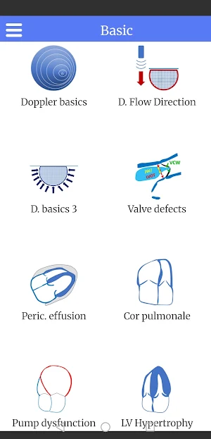 EM Demo: Echo Basics Screenshot 2