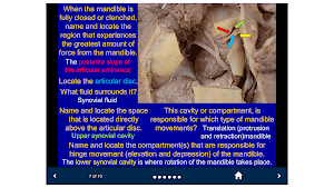 Head & Neck Anatomy-SecondLook Screenshot 3