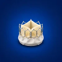 MYValve Log