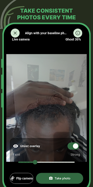 Follicle - Hair Growth Tracker Screenshot 1