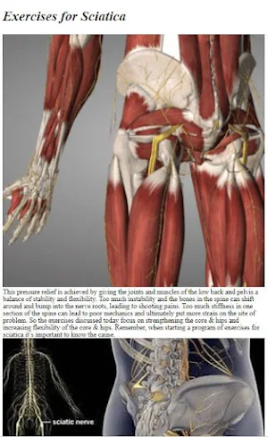How to Do Exercise fo Sciatica Screenshot 3