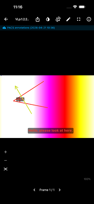 MedView Screenshot 2