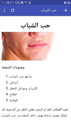 Facial acne treatment Screenshot 2