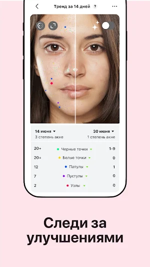 Skinepic – личный косметолог Screenshot 3