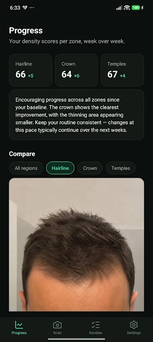 HairProof: Hair Loss Tracker Screenshot 1