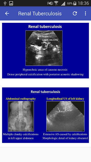 Ultrasound Urinary Tract Screenshot 0