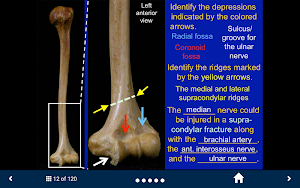 MSK Anatomy - SecondLook Screenshot 3