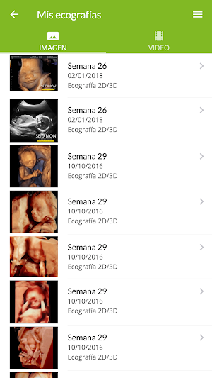 Mi embarazo en HURS Screenshot 2