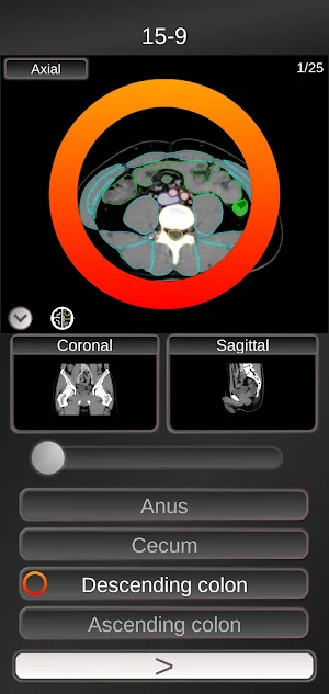 CT PassQuiz Abdomen / sectional anatomy / MRI Screenshot 0