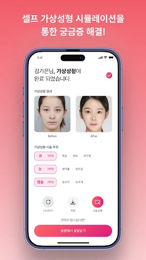 예뻐지다 - 가상성형 & 병원상담 예약 성형어플 Screenshot 2