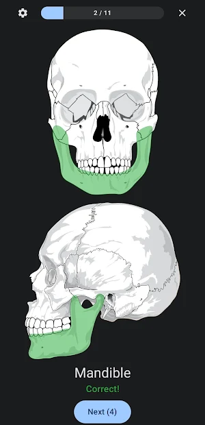 Anatomy Quiz: Bones Screenshot 3