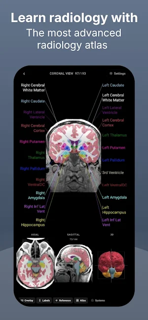 RadioAnatomy Screenshot 0