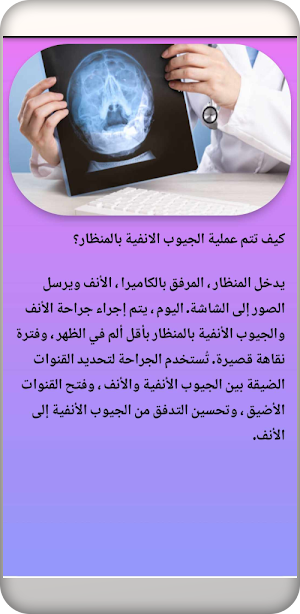 علاج الجيوب الأنفية في المنزل Screenshot 2