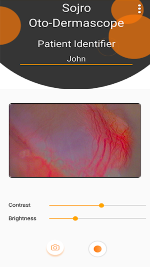 Oto-Dermascope Screenshot 2